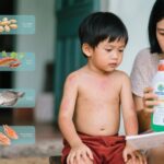 Dị Ứng Da Ở Trẻ Em: Hiểu Biết và Giải Pháp Từ Việc Tiếp Xúc Với Chất Tẩy Rửa Đến Thực Phẩm