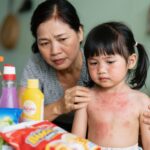Dị Ứng Da Ở Trẻ Em: Nguyên Nhân, Triệu Chứng và Giải Pháp An Toàn Từ Thực Tiễn Việt Nam