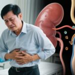 Dấu Hiệu Cảnh Báo Sớm Sỏi Thận và Khi Nào Cần Thăm Khám Y Tế