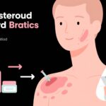 Khôi phục từ viêm da do corticosteroid do mỹ phẩm giả mạo