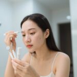 Hướng Dẫn An Toàn Cách Nặn Mụn Tại Nhà Theo Phong Cách Y Tế